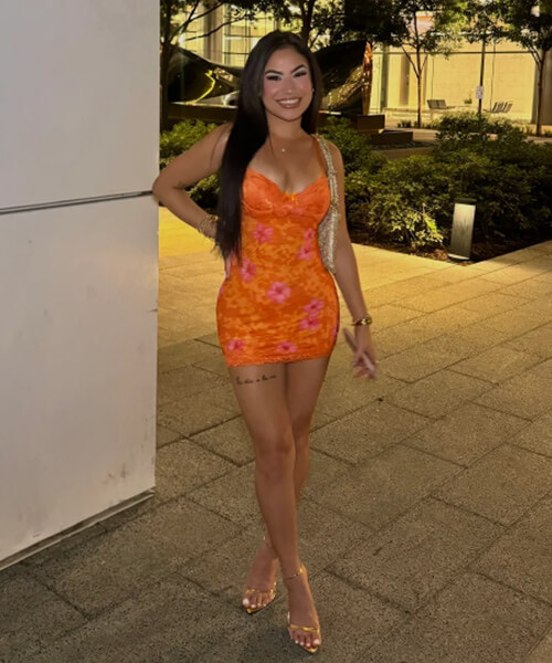 WOW Cosmetic Surgery patient selfie 1